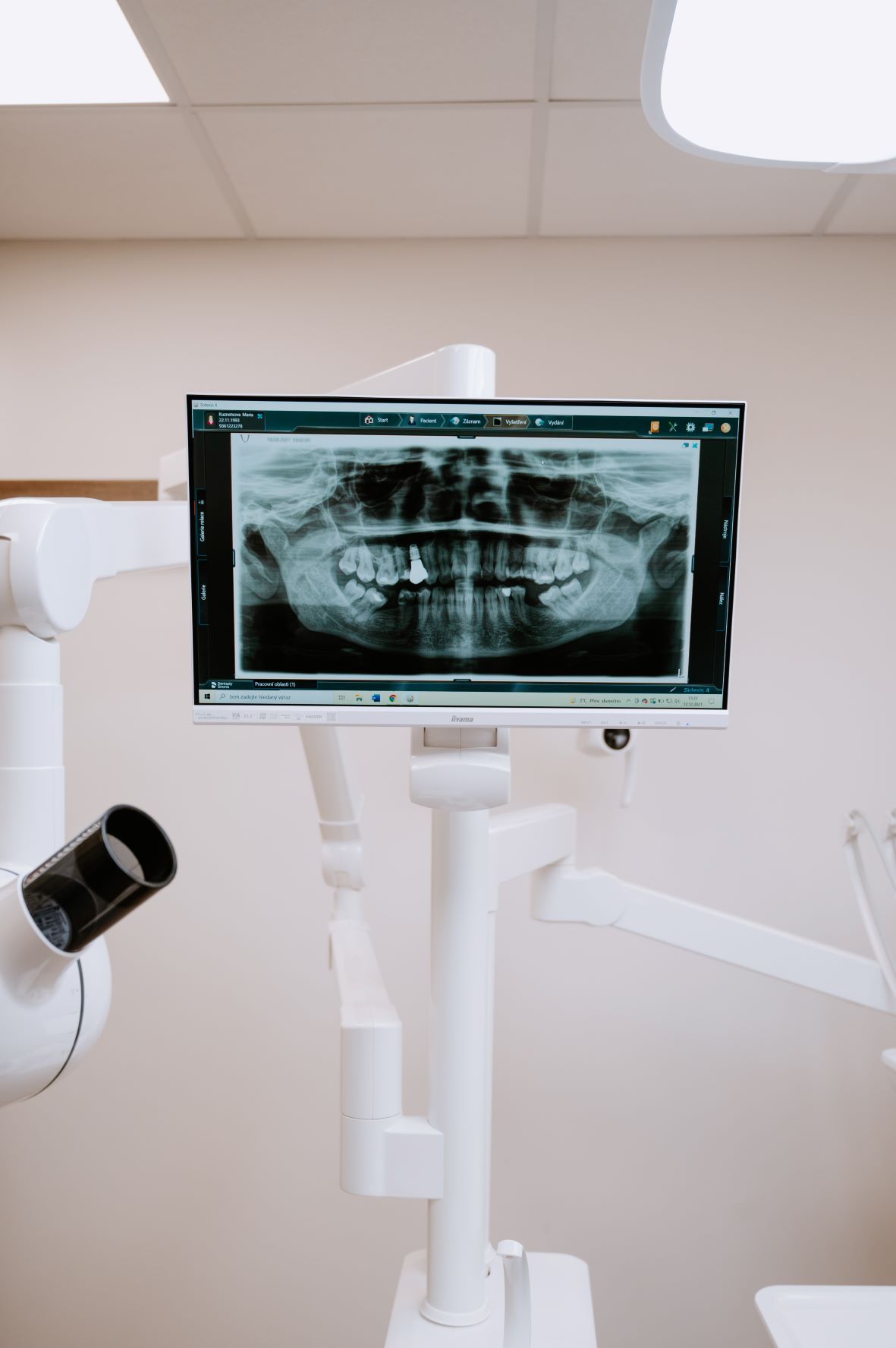 Zubní implantáty IMAGE #1