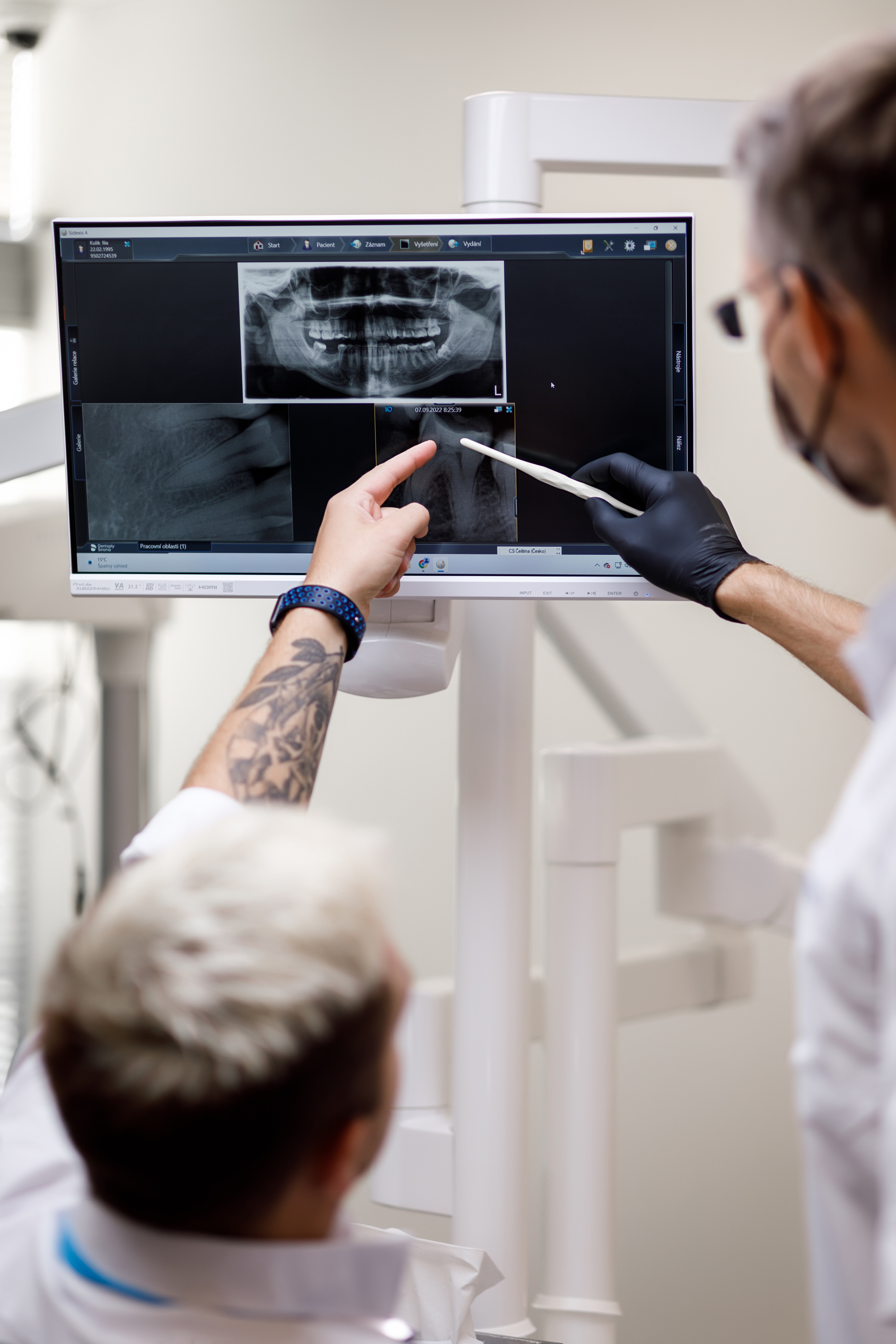 Léčba na splátky IMAGE #1