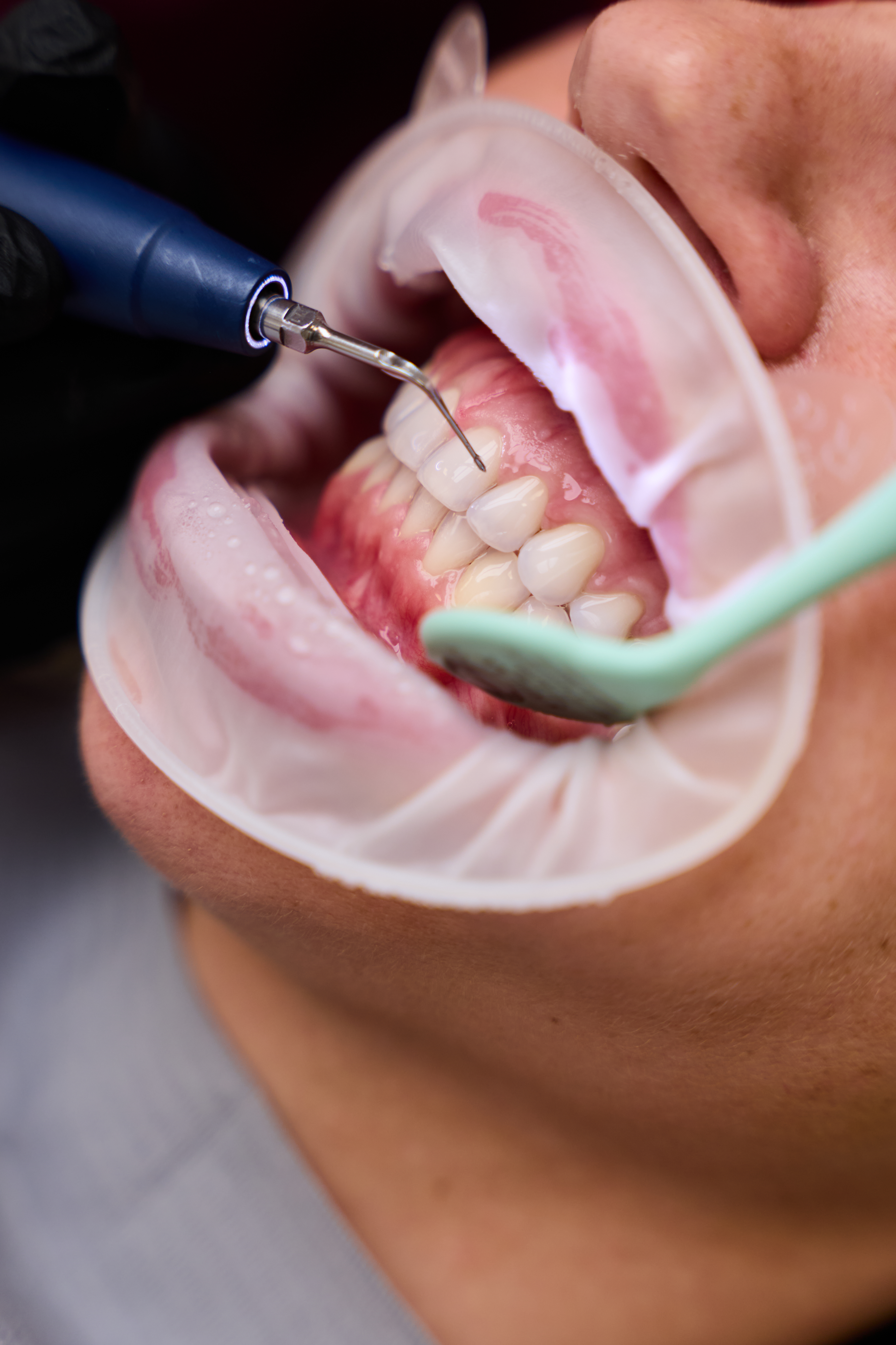 Dentální hygiena IMAGE #1