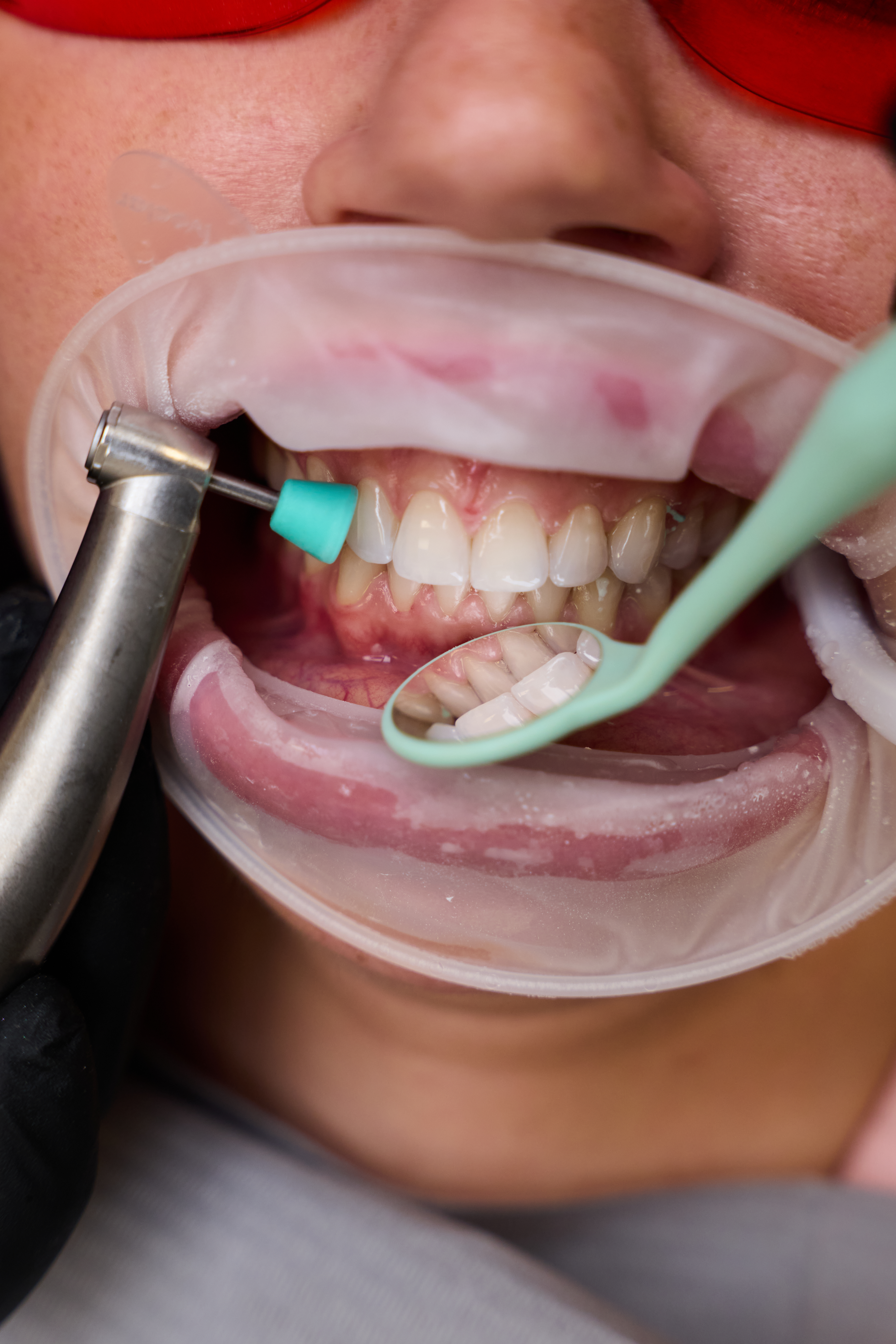 Dentální hygiena IMAGE #2
