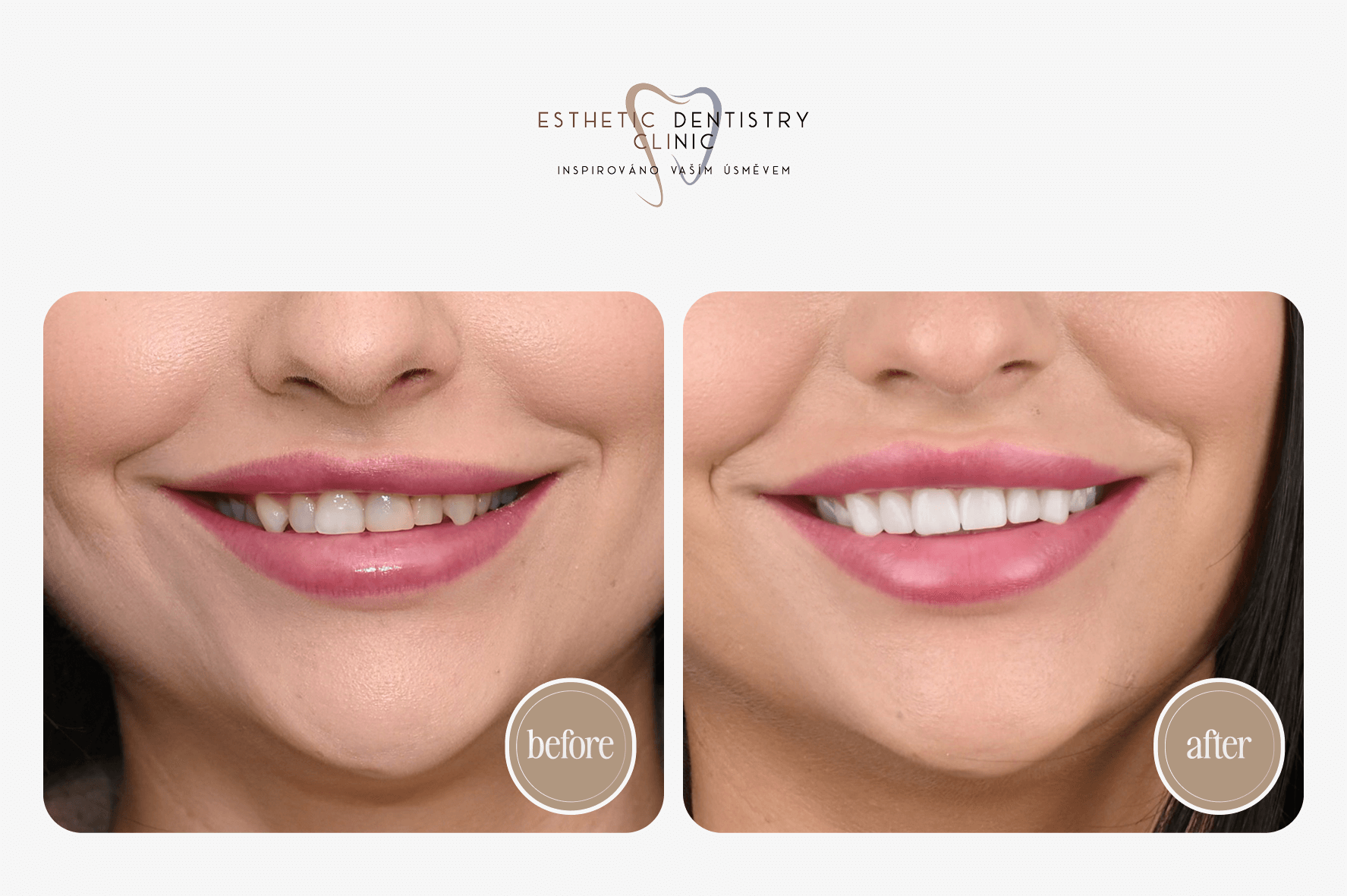 Hledáme modely a modelky pro stomatologická ošetření IMAGE #0