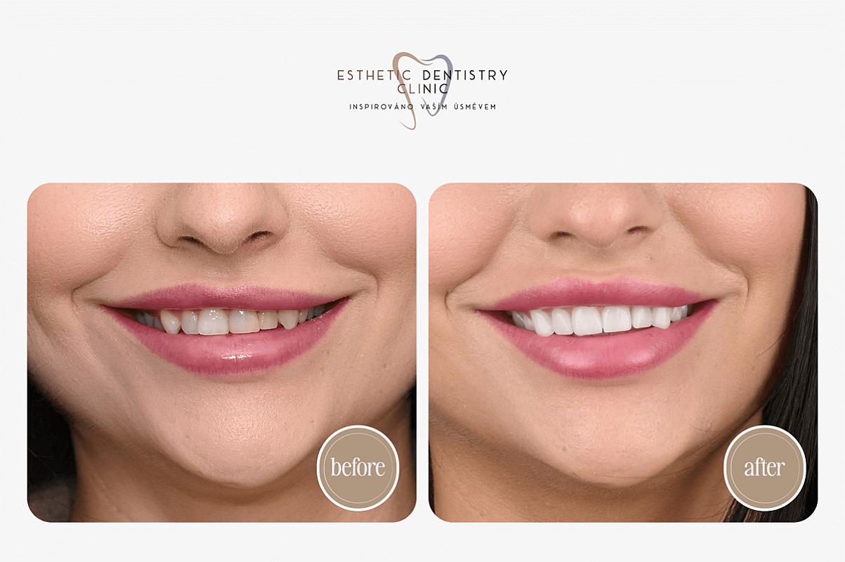 Hledáme modely a modelky pro stomatologická ošetření